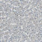 TAF6 Antibody in Immunohistochemistry (Paraffin) (IHC (P))
