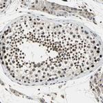 TAF6 Antibody in Immunohistochemistry (Paraffin) (IHC (P))