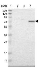 TAF6 Antibody in Western Blot (WB)
