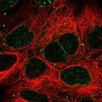 SLC2A13 Polyclonal Antibody