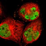 RBM14 Polyclonal Antibody