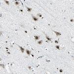RBM14 Antibody in Immunohistochemistry (Paraffin) (IHC (P))