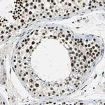 RBM14 Antibody in Immunohistochemistry (Paraffin) (IHC (P))