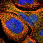 ZNF96 Polyclonal Antibody