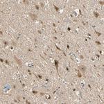 ZNF96 Antibody in Immunohistochemistry (Paraffin) (IHC (P))