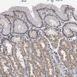 TSTD1 Polyclonal Antibody