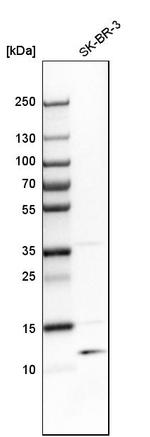 TSTD1 Antibody in Western Blot (WB)