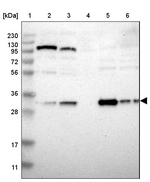 NIT1 Antibody in Western Blot (WB)