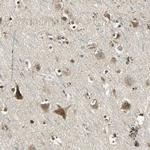 NIT1 Polyclonal Antibody