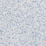 ITLN2 Antibody in Immunohistochemistry (Paraffin) (IHC (P))