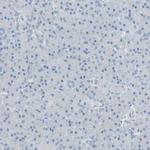 ITLN2 Polyclonal Antibody