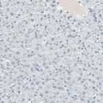 ITLN2 Antibody in Immunohistochemistry (IHC)