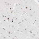 ZNF512B Antibody in Immunohistochemistry (Paraffin) (IHC (P))