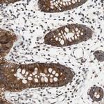 ZNF512B Antibody in Immunohistochemistry (Paraffin) (IHC (P))