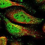 RAD1 Polyclonal Antibody