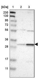 RAD1 Antibody in Western Blot (WB)