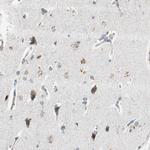 PSMB4 Antibody in Immunohistochemistry (Paraffin) (IHC (P))