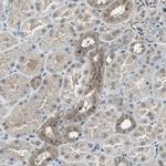 PSMB4 Antibody in Immunohistochemistry (Paraffin) (IHC (P))