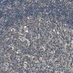 PSMB4 Antibody in Immunohistochemistry (Paraffin) (IHC (P))