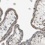 PSMB4 Antibody in Immunohistochemistry (Paraffin) (IHC (P))