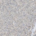 PSMD8 Antibody in Immunohistochemistry (IHC)