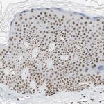 RTF1 Antibody in Immunohistochemistry (Paraffin) (IHC (P))
