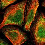 POLH Polyclonal Antibody