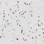 POLH Antibody in Immunohistochemistry (Paraffin) (IHC (P))