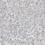 POLH Antibody in Immunohistochemistry (Paraffin) (IHC (P))