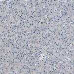 POLH Antibody in Immunohistochemistry (Paraffin) (IHC (P))