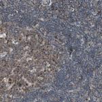 POLH Antibody in Immunohistochemistry (IHC)