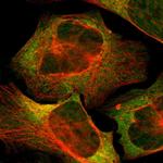 USP10 Polyclonal Antibody