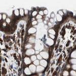 USP10 Antibody in Immunohistochemistry (IHC)