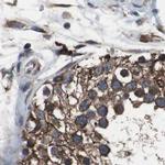 USP10 Antibody in Immunohistochemistry (IHC)