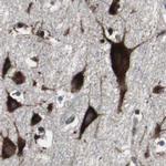 USP10 Antibody in Immunohistochemistry (IHC)