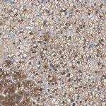 FADS2 Polyclonal Antibody