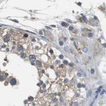 USP10 Antibody in Immunohistochemistry (IHC)
