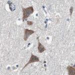USP10 Antibody in Immunohistochemistry (IHC)