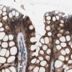 USP10 Antibody in Immunohistochemistry (IHC)