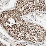 USP5 Antibody in Immunohistochemistry (Paraffin) (IHC (P))