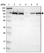 USP5 Antibody in Western Blot (WB)