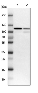 USP5 Antibody in Western Blot (WB)