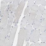 TSC22D4 Antibody in Immunohistochemistry (Paraffin) (IHC (P))