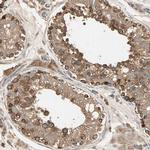 DAP5 Antibody in Immunohistochemistry (IHC)