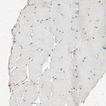 DAP5 Antibody in Immunohistochemistry (IHC)