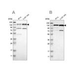 USP28 Antibody in Western Blot (WB)