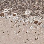 DRAP1 Antibody in Immunohistochemistry (IHC)