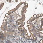 SMG1 Polyclonal Antibody