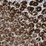 DC13 Polyclonal Antibody