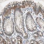 NKAIN1 Polyclonal Antibody